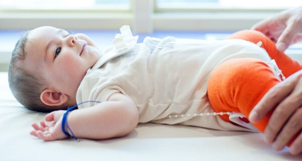 Kalça Çıkığı Belirtileri