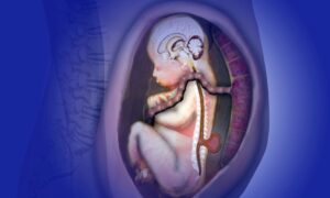 Spina Bifida Hastalığı Nedir?